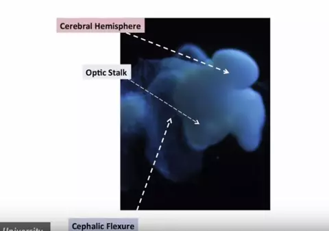 Cercetătorii americani au creat un... CREIER aproape perfect, în laborator! La ce vor să-l folosească