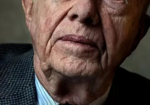 Un fost preşedinte american, diagnosticat cu CANCER LA FICAT