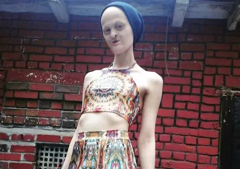 Toată viața lumea a râs de ea pentru că nu are dinți, păr și e parțial oarbă. Acum a ajuns celebră