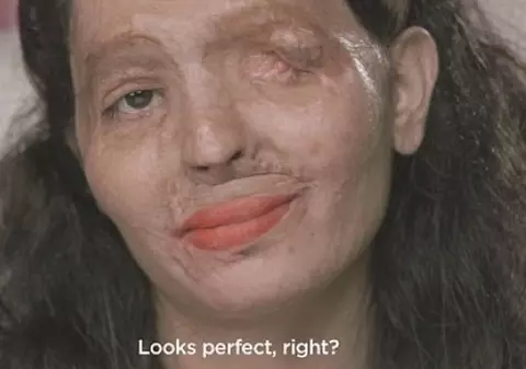 O tânără a fost mutilată de unchiul ei. Cum se machiază pentru a putea ieși din casă | VIDEO 