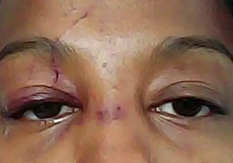 O femeie susţine că a fost bătută pentru că e "prea frumoasă". Cum arată tânăra atacată în plină stradă