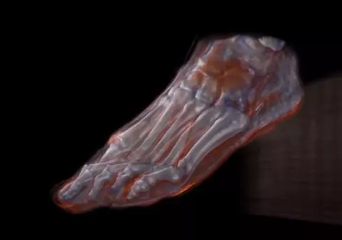 Studiu în interiorul unei "fantome umane". Cadavrul unei femei a fost tăiat în 5.000 de bucăți. Ce s-a descoperit | FOTO &VIDEO