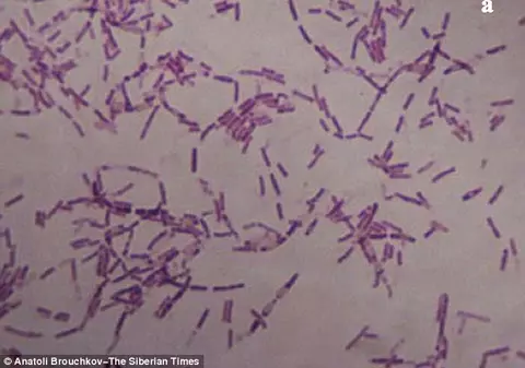 Un cercetător rus susține că a descoperit secretul vieții veșnice în urma unei injecții