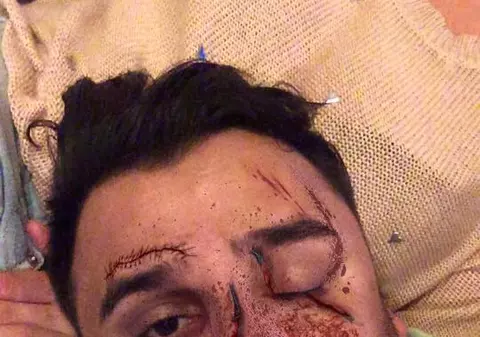 Liviu Guță, bătut crunt! Toate cunoștințele sale sunt îngrozite