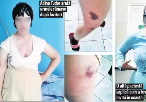 Autorităţile spun că aceste imagini sunt o iluzie! Bolnavii nu au vânătăi, aşa cum se vede, şi nu spun că au fost bătuţi, aşa cum se aude în înregistrarea video