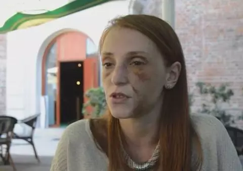 Câţi bani vrea tânăra bătută timp de 22 de ore de la bărbatul care a desfigurat-o