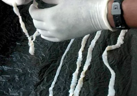 Caz incredibil în MEDICINĂ! De ce a murit un bărbat de CANCER, deși NU AVEA CANCER