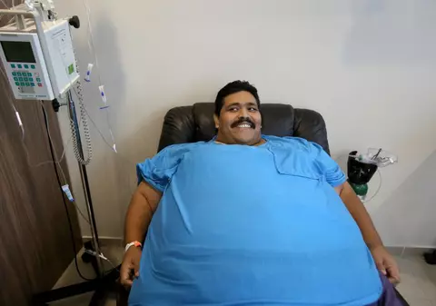 A murit cel mai gras om din lume. Andres Moreno avea 444 de kilograme 