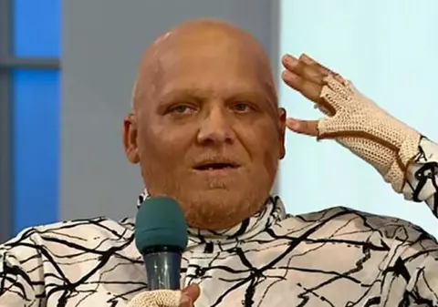 Cea mai proastă veste pentru "Stilistul vedetelor". Bolnav de cancer, Marian Dârţă a ajuns în culmea disperării