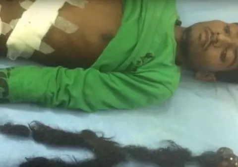 Se plângea de dureri de stomac! Incredibil ce au scos doctorii din abdomenul unui tânăr de 18 ani! VIDEO