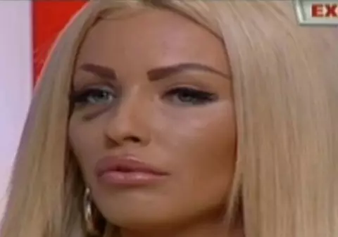 Loredana Chivu, BĂTUTĂ şi jefuită în scara blocului. Un bărbat a agresat-o din senin