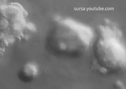 Formarea celulelor canceroase, filmată în premieră! Ce s-a descoperit | VIDEO