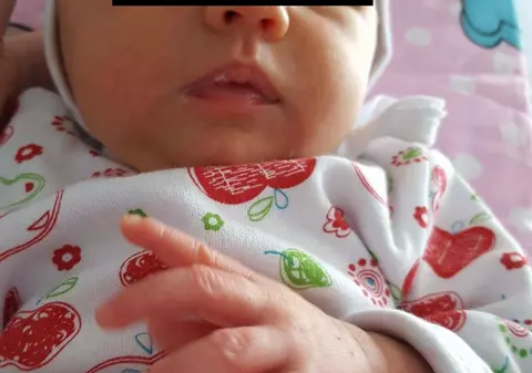 Scandalos! Li s-a spus că fiica lor are nevoie de o operație ”banală”, dar a fost ucisă de o tumoră gigant