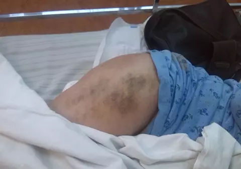 Revoltător! O bătrână din Vaslui, ignorată de medici şi lăsată cu dureri crunte pe patul de spital