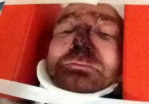 Uluitor! A luptat pe front, dar a fost snopit în bătaie de iubită! Uite ce a pățit un veteran de război!