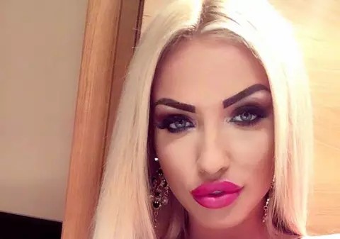 Loredana Chivu şi-a operat nasul. Cum arată acum fosta asistentă | FOTO ÎN ARTICOL