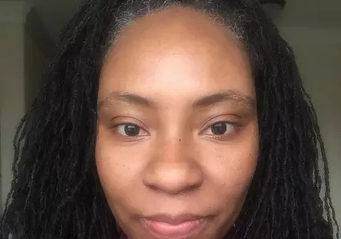 Desfigurată după ce s-a vopsit la un salon | FOTO