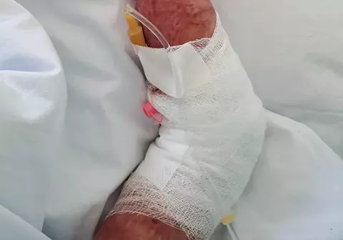 Mărturia unei supraviețuitoare din Colectiv: ”Tatuajul nu este nou, a fost mutat de pe picior” IMAGINI CU IMPACT EMOȚIONAL