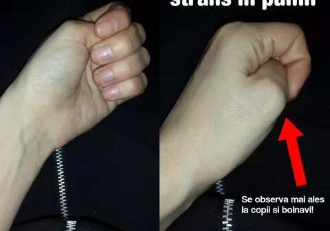 Degetul opozabil – cel mai important deget al mâinii îți dă de gol caracterul