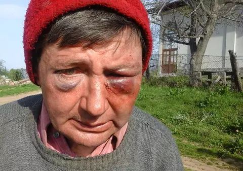 Profesor din Mehedinţi bătut crunt de persoane necunoscute! Au intrat cu toporul peste el în casă!