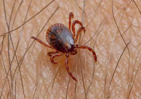 Atacul insectelor continuă! Sute de oameni au ajuns la spital după ce au fost mușcați de căpușe