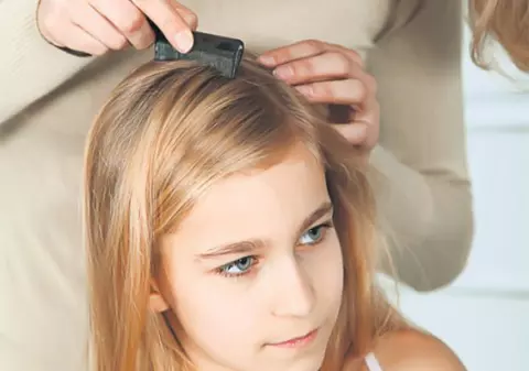 Românii cred că păduchii sunt o problemă de igienă