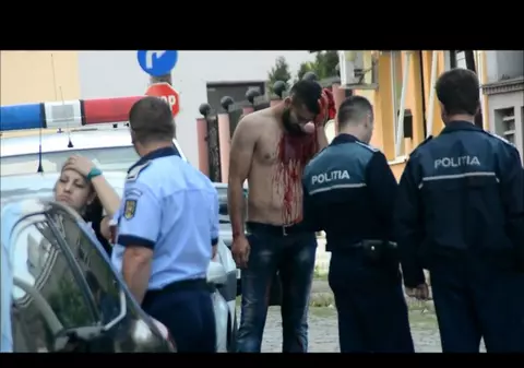 IMAGINI ȘOCANTE! Conflict sângeros într-un bar din Buzău, după meciul României