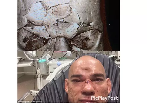 Imagini horror după o gală MMA la Londra. I-a rupt capul! | VIDEO