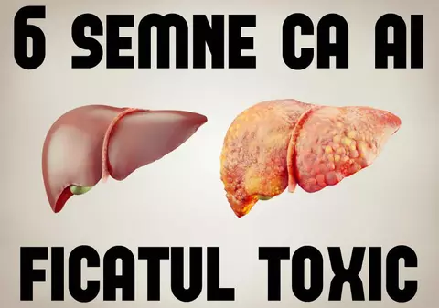 Semne mai puțin cunoscute care îți spun că ai un ”ficat toxic”