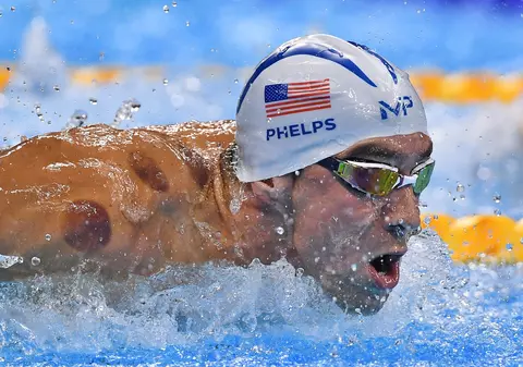 Jocurile Olimpice. S-a descoperit de unde provin petele roșii de pe corpurile sportivilor de la Rio | GALERIE FOTO