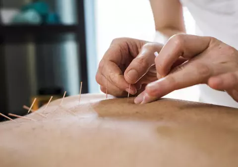 (Publicitate) Care sunt tratamentele de care puteți beneficia apeland la acupuncturabucuresti.ro?