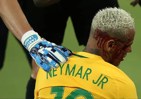 Neymar a plătit cu sânge golul 300. Un bolivian i-a spart fața starului Barcelonei cu un procedeu de MMA / GALERIE FOTO&VIDEO