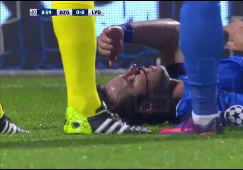 Liga Campionilor, etapa a 5-a. Mățel, titular, dar schimbat, cu nasul spart. Nebunie la Dortmund, 8-4! Rezultate, televizări, clasamente / VIDEO