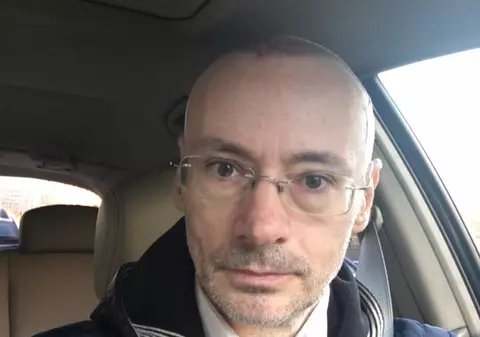 Imagine horror cu Mihai Albu după ce și-a făcut implant de păr. Fața lui e desfigurată