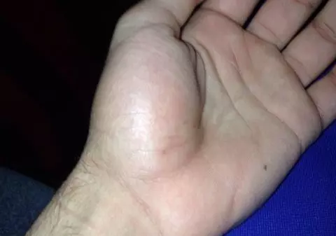 Cum arată Gabriel Dodoi după accidentarea de pe patinoarul de la Tg. Mureș. Asta a determinat echipa Pandurii să nu mai iasă pe gazon