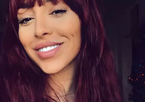 EXCLUSIV/ Adevărata ei față de când și-a micșorat buzele! Ruby, complet nemachiată