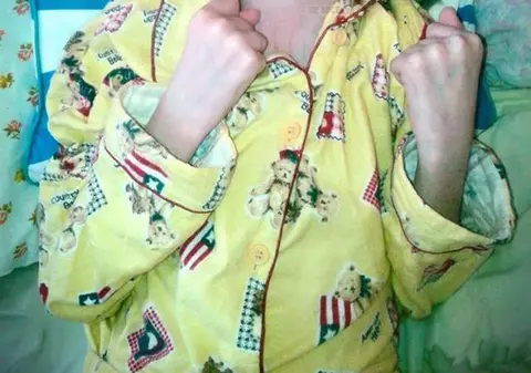 110.000 de euro daune pentru o fetiţă rămasă paralizată de 4 ani în urma unui accident