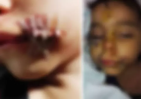 Copil mușcat de cap de un câine în județul Suceava. Clipe de groază pentru băiețelul de numai un an