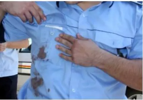 Un polițist a fost mușcat de doi indivizi din Suceava. Agresorii au fost arestați, după ce au folosit și un aparat cu electroșocuri