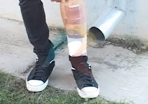 VIDEO. Riscă să-și piardă un picior, după ce a luat o infecție din spital. Părinţii susţin că s-a infectat în spitalul din Turceni