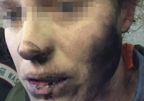 O femeie a fost rănită de căștile sale, care au explodat în timpul unui zbor