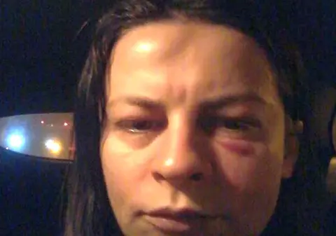 Consilierul județean PNL Timiș, Adrian Pășcuță, e acuzat de violențe. Soția politicianului a apărut vânătă la ochi și cu un cucui în frunte