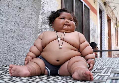 Bebeluș obez în India. La opt luni, o fetiță cântărește 17 kilograme