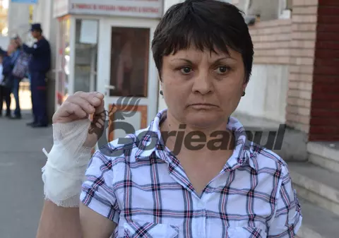 O femeie din Gorj a fost mușcată de câinii vecinilor. Animalele din rasa Rottweiler, care au atacat-o, sunt printre cei mai periculoși câini de luptă