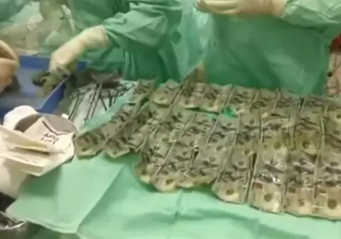 VIDEO| A înghiţit 7000 de dolari în timp ce se certa cu soţul ei