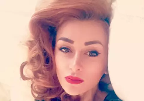 Denisa Tănase de la Bambi s-a „botoxat”. Cum arată la 3 zile după tratament