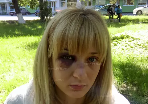 Femeie bătută de fostul soț în județul Vaslui. Uluitor cum a fost salvată tânăra de la moarte