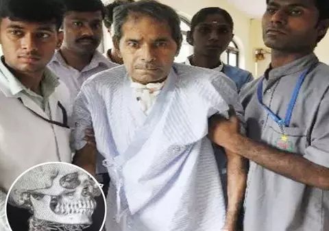 Cazul care i-a uimit pe medici: Un bărbat avea 150 de ace înfipte în corp, însă nu știe cum s-a întâmplat asta