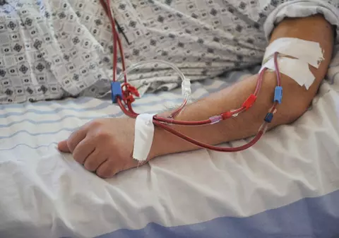 EXCLUSIV. Pacienții nu mai au acces la medicație din cauza prețurilor: ”În curând, nu vom avea cu ce să ne tratăm”