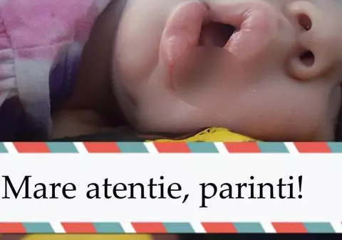 Fetita va ramane cu cicatrici pe viata dupa ce a bagat asta in gurita! Atentie, parinti!